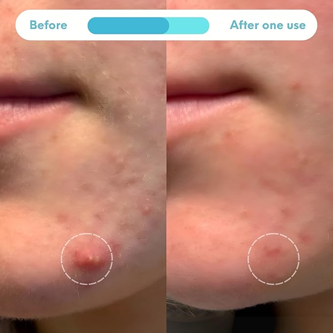 Guida Completa alla Skin Care: Cura della Pelle, Routine Quotidiana e Prodotti Viso Migliori